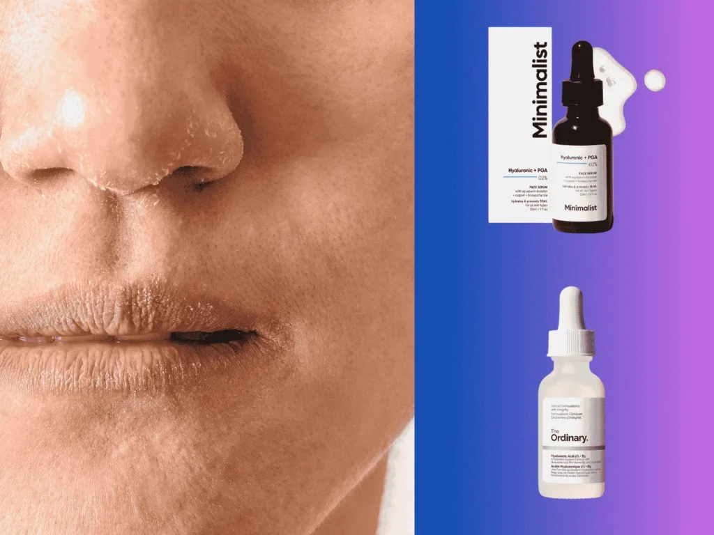 Hyaluronic Acid