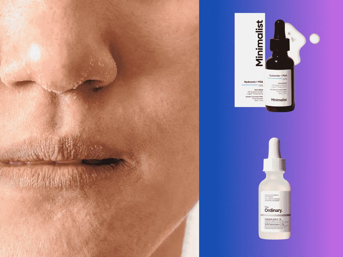 Hyaluronic Acid